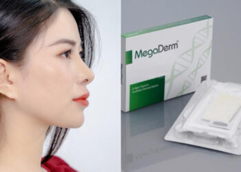 Giá nâng mũi bọc megaderm bao nhiêu